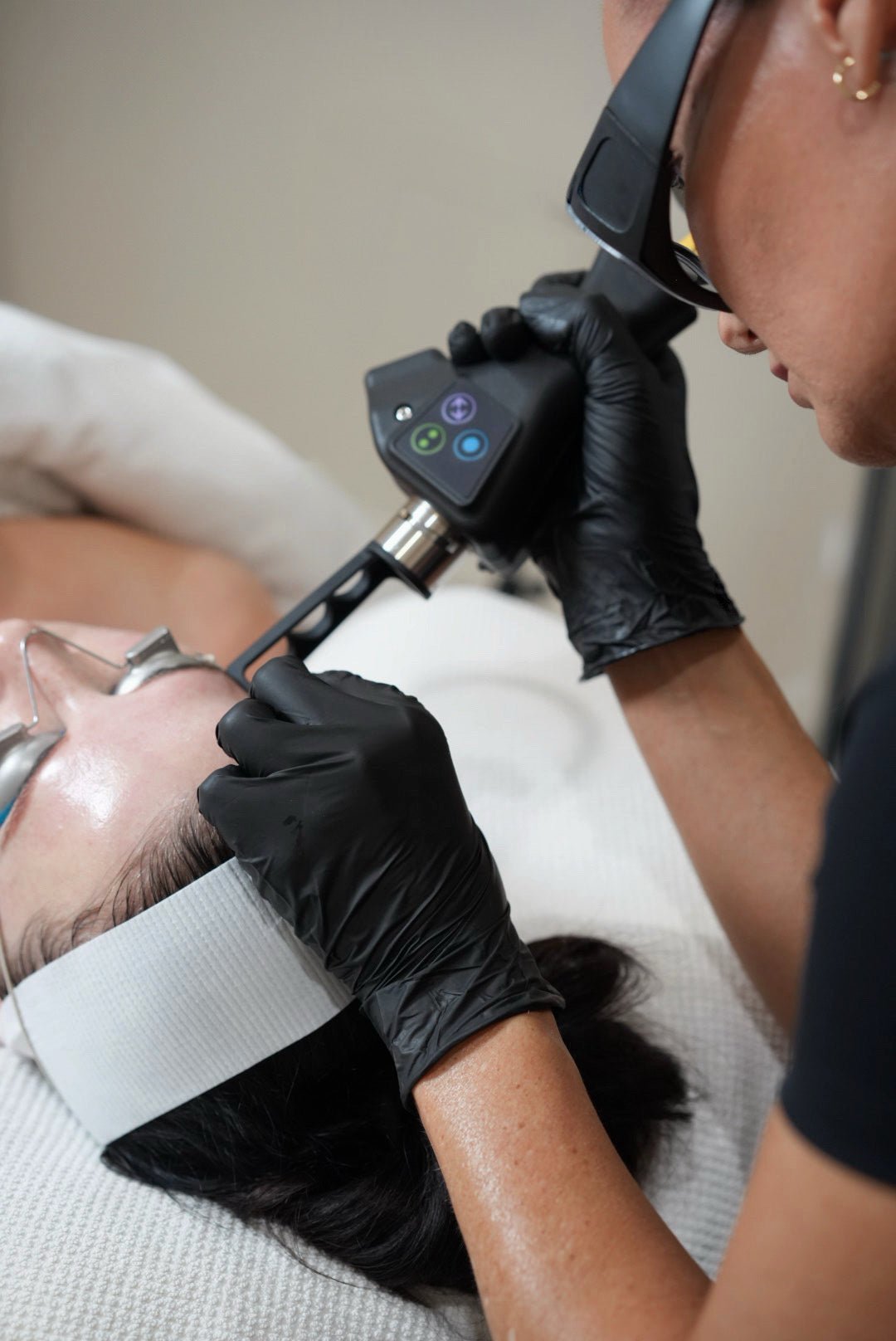 CO₂ Laser vs Morpheus8: Which Treatment Is Right for You?